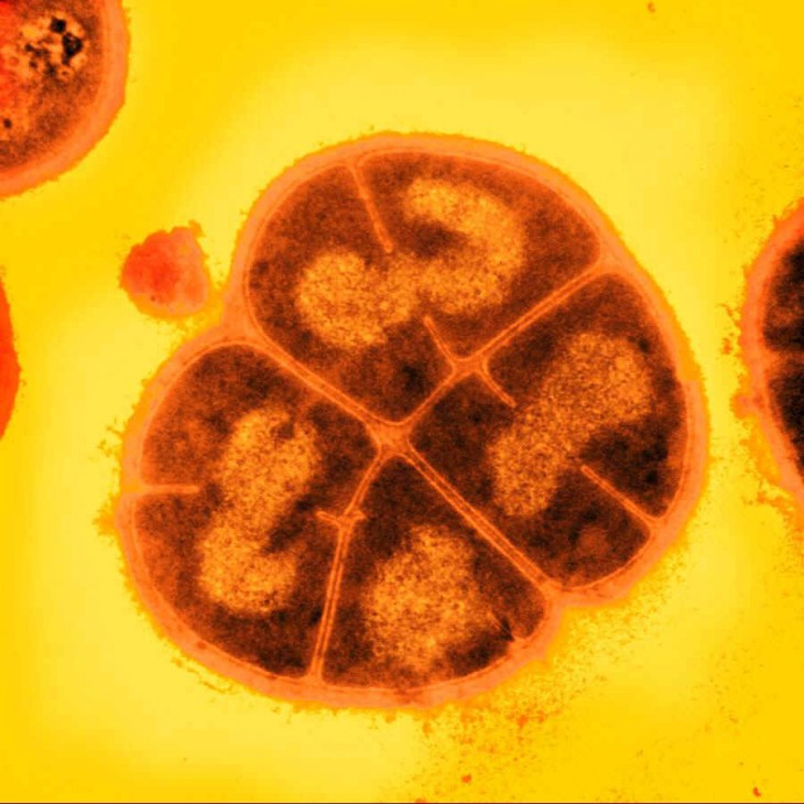 Deinococcus.jpg